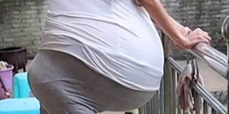 Se mystisk video: Kvindens mave svulmer massivt op