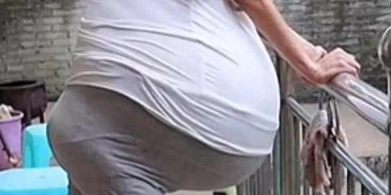 Se mystisk video: Kvindens mave svulmer massivt op