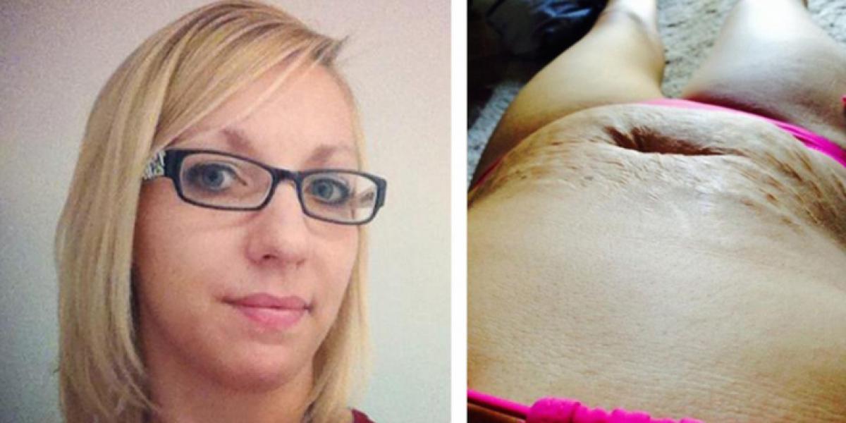 De hånede moderen, da hun gik på stranden i bikini: Gik grædende hjem og skrev et svar