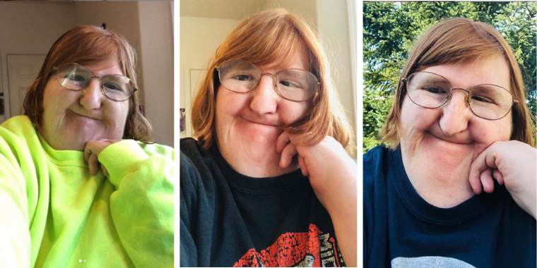 Melissa fik at vide, at hun var for grim til Instagram: Så gjorde hun dette