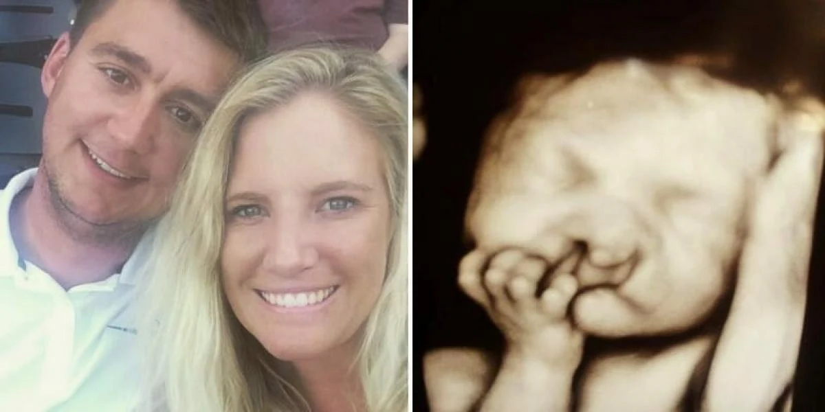 Forældre nægter at afbryde graviditet med misdannet baby: Sådan ser barnet ud flere år efter