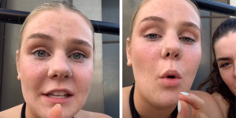 20-årige Mollie blev smidt ud af bar på grund af sit tøjvalg