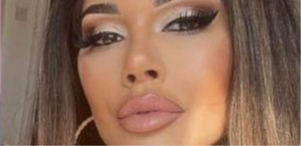 Kvinde bliver opereret og får lavet ‘katteøjne’: Resultatet efterlader folk i chok