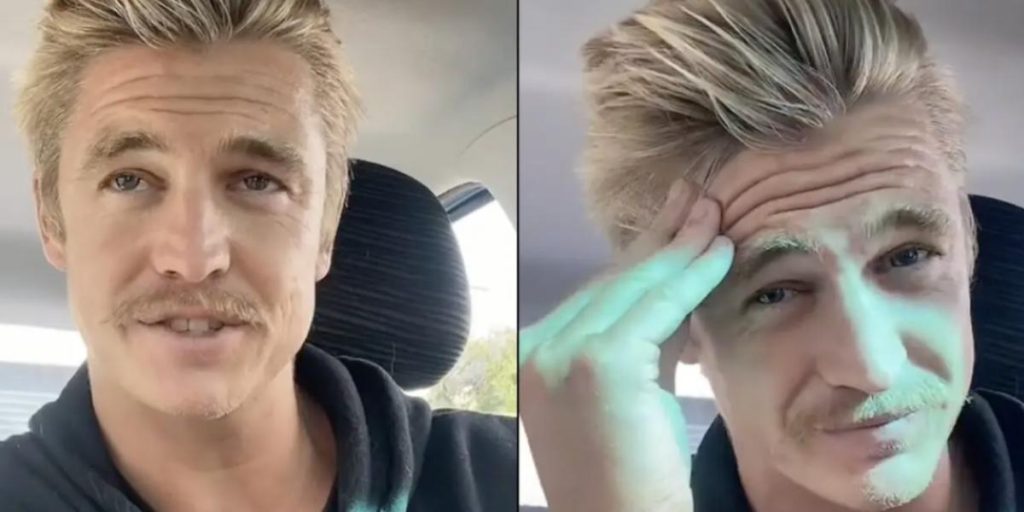 Nick har ikke vasket hår i 6 år: Det er der sket med det