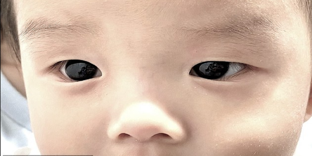 6 måneder gammel baby fik helt særlig medicin: Forældrene fik et chok, da de så bivirkningerne