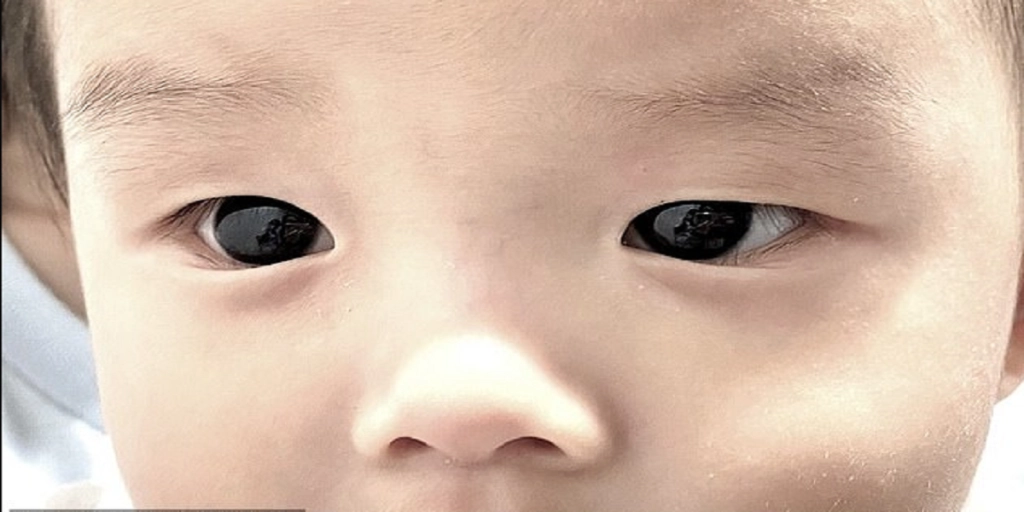6 måneder gammel baby fik helt særlig medicin: Forældrene fik et chok, da de så bivirkningerne