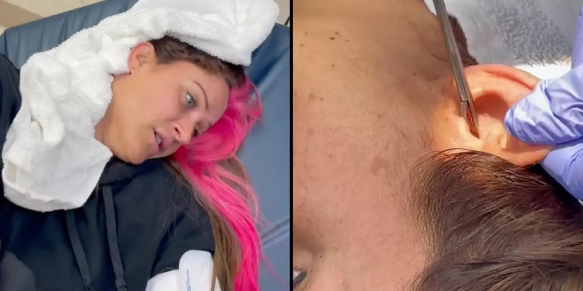 Kvinde tog på hospitalet med smerter i øret: Du gætter aldrig, hvad lægen hiver ud