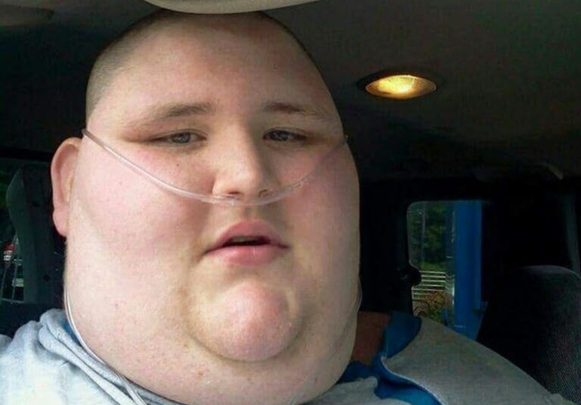 25-årig fik 6 måneder tilbage at leve i: Familie kunne ikke genkende ham