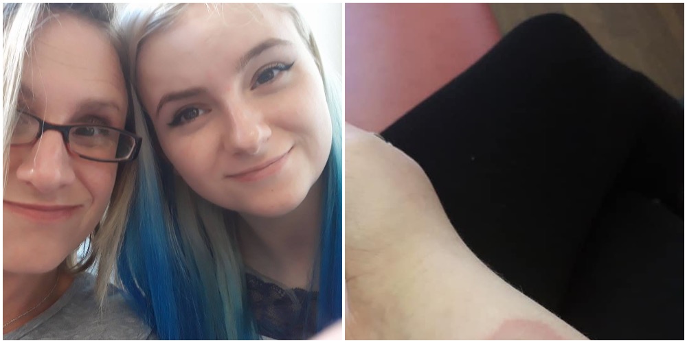 Mor deler vanvittigt billede af 10-årig datters arm og advarer mod tåbelig trend