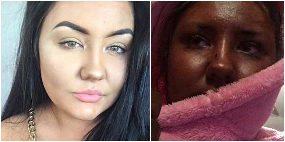 20-årige kvinde prøvede ny selvbruner: Nu griner alle af hende