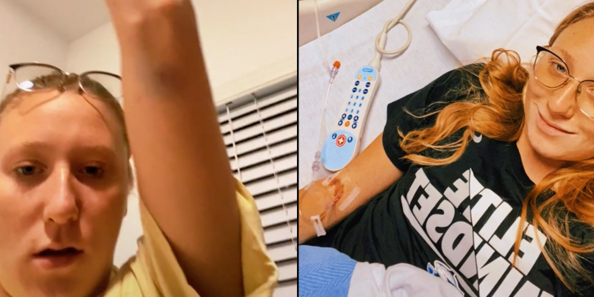 21-årig kvinde opdagede små ‘prikker’ på sin hud: Beskeden hun fik af lægen slog hende ud