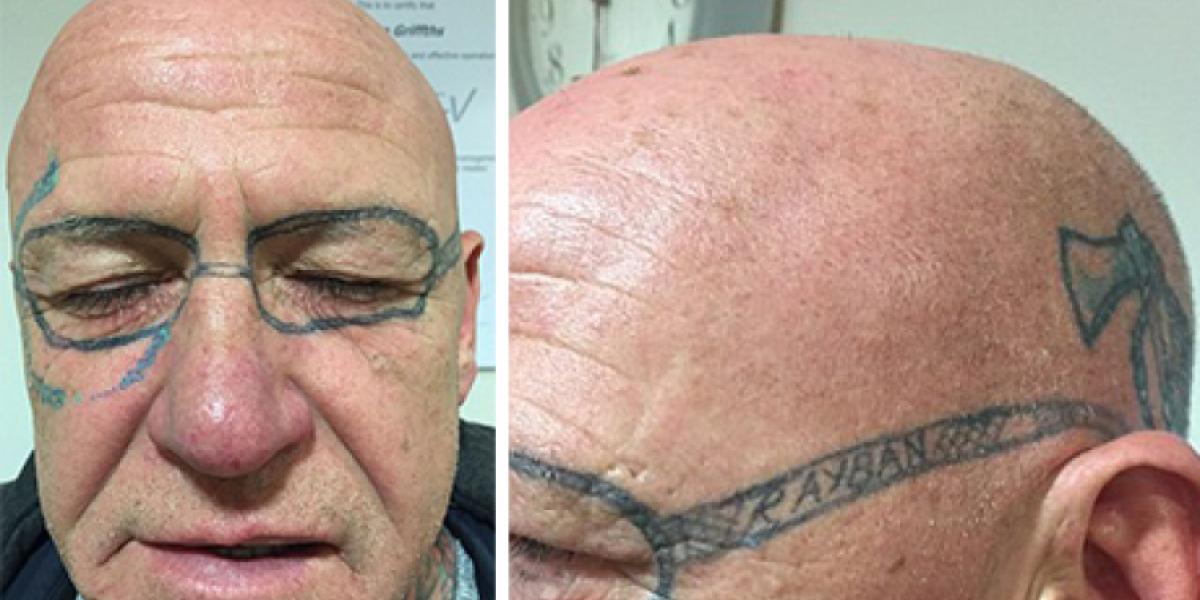 Mand vågner efter vild druktur med drengene med et par Ray Ban-solbriller tatoveret i sit ansigt