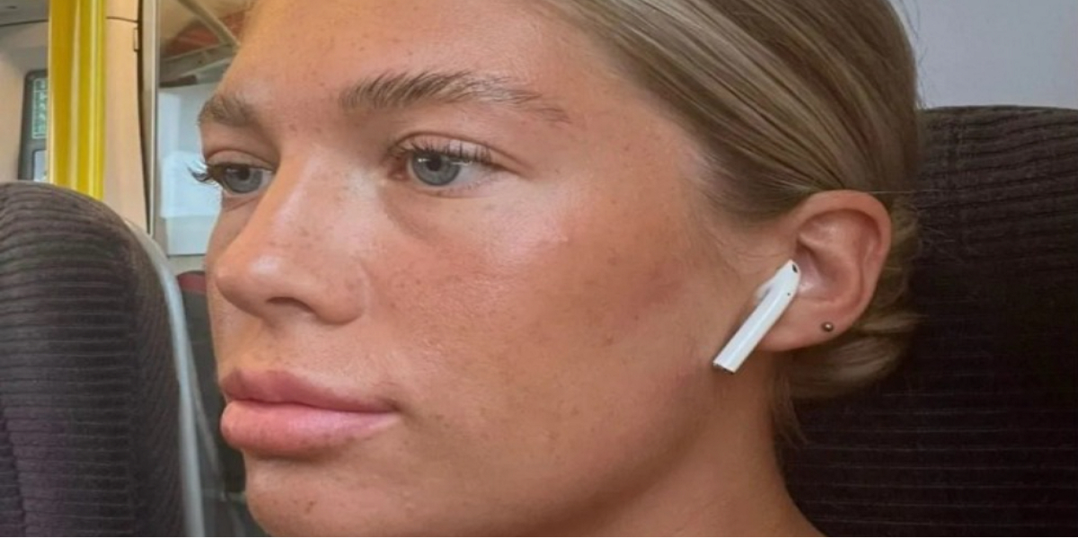 Kvinde lod sin veninde tatovere hendes øjenbryn: Det kom hun hurtigt til at fortryde