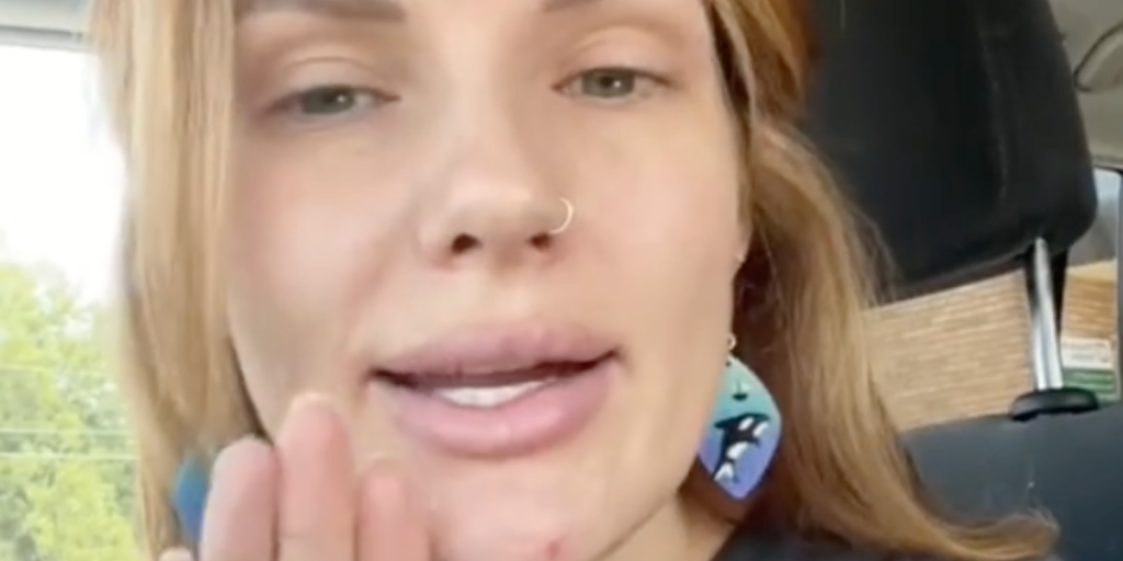 Kvinde i chok over, hvad man kan se på røntgenbilleder: ‘Hvorfor har ingen fortalt mig det?’