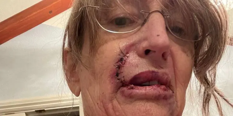 66-årig kvinde troede, at larm i køkkenet kom fra hendes søn: Fik sit livs chok, da hun opdagede hvem lyden kom fra