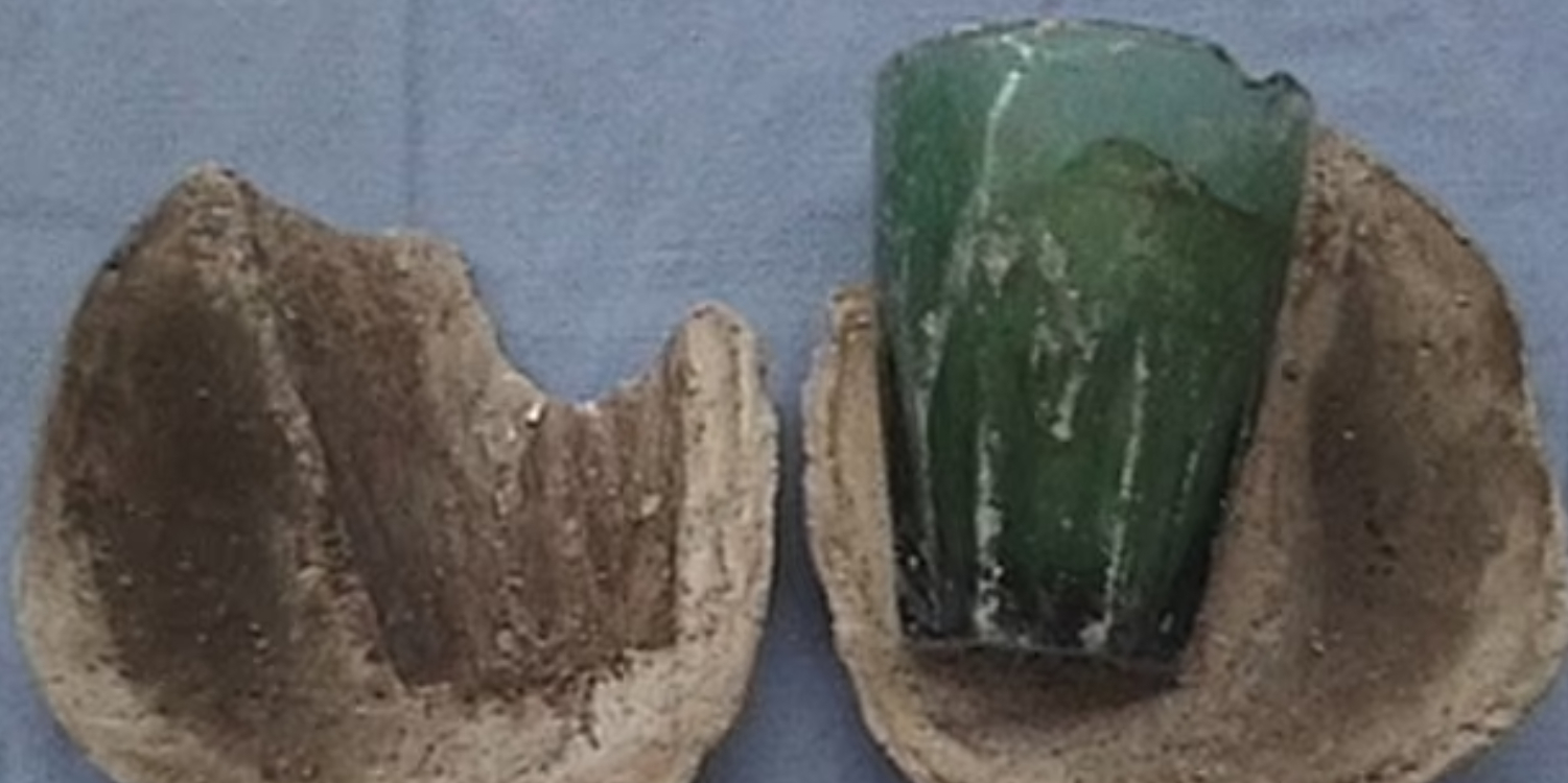 Tog til lægen med mistanke om en UVI og opdagede en gigantisk blæresten: Årsagen var chokerende