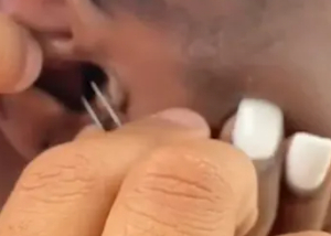 Hun var ude at snorkle: Så fik hun en ulækker overraskelse i øret