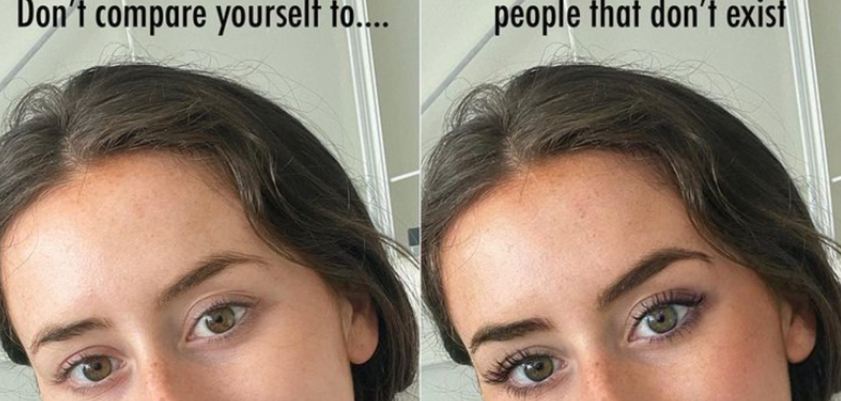 Influencer vil gøre op med uopnåelige idealer: Deler billede før og efter “to minutters” redigering