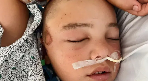 12-årig dreng var få minutter fra at dø, efter at han faldt ud af sin køjeseng