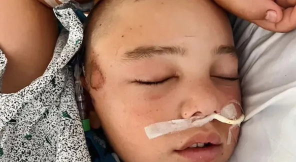 12-årig dreng var få minutter fra at dø, efter at han faldt ud af sin køjeseng