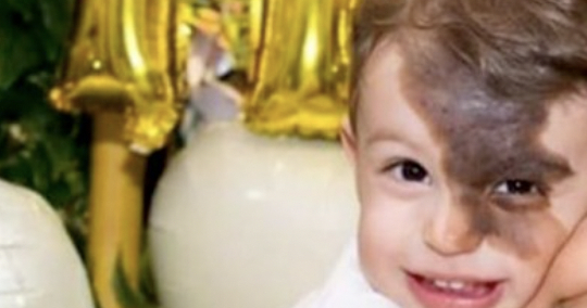 Modermærket fik ham til at føle sig anderledes: Så gjorde moren noget fantastisk