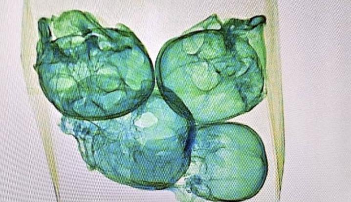 Grænsepoliti i chok: Gjorde grusomt fund i kuffert