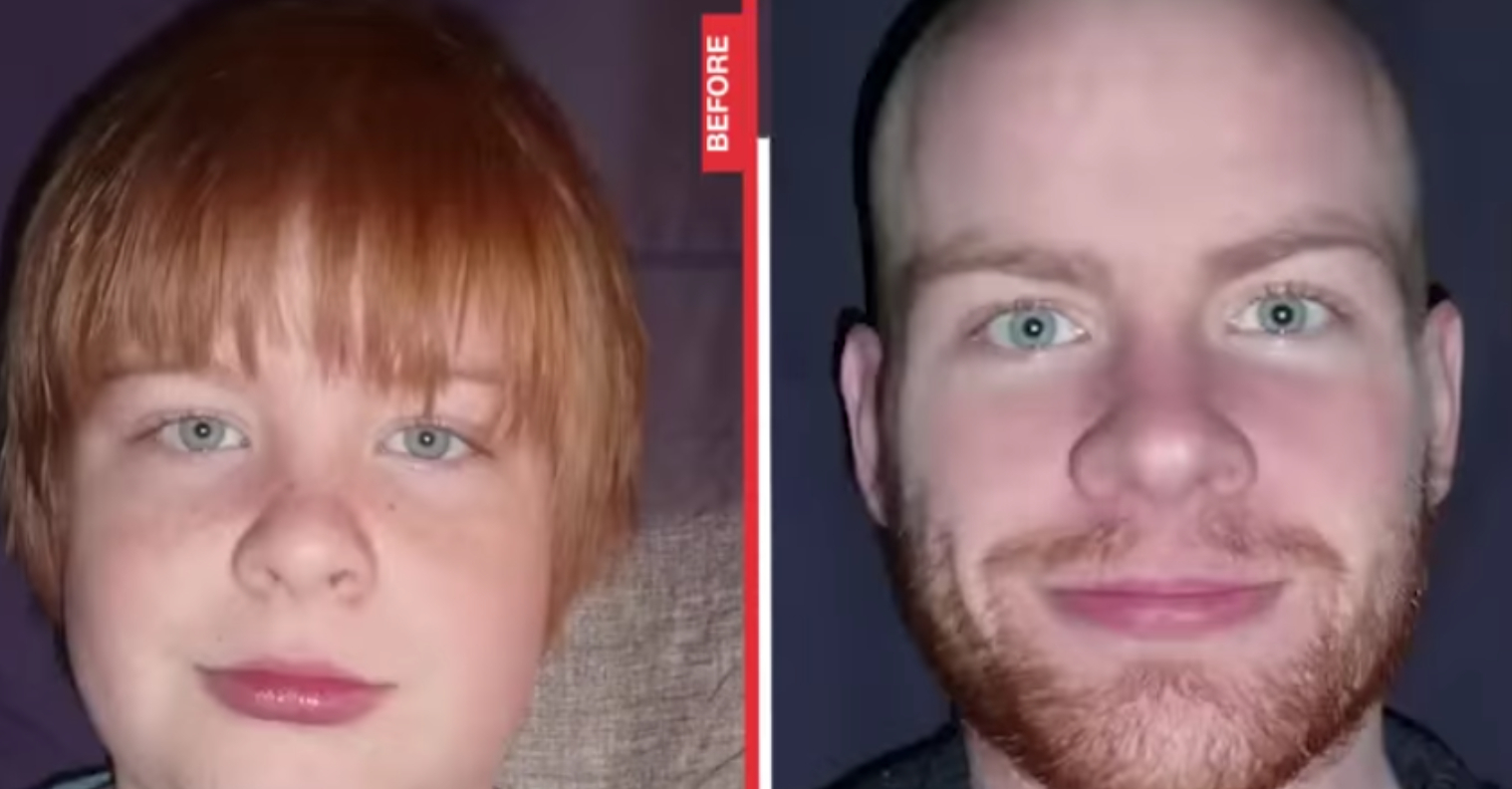 Han tog én selfie hver dag i 15 år: Resultatet er utroligt