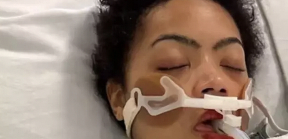 Hun havde nær mistet livet efter hun blev skudt: Har kostet hende 1,3 millioner kroner