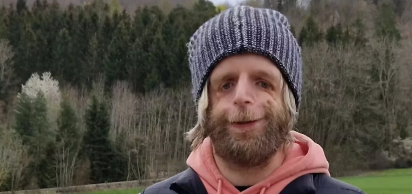 Hans forældre forlod ham 36 timer efter fødslen: Væmmedes ved hans udseende