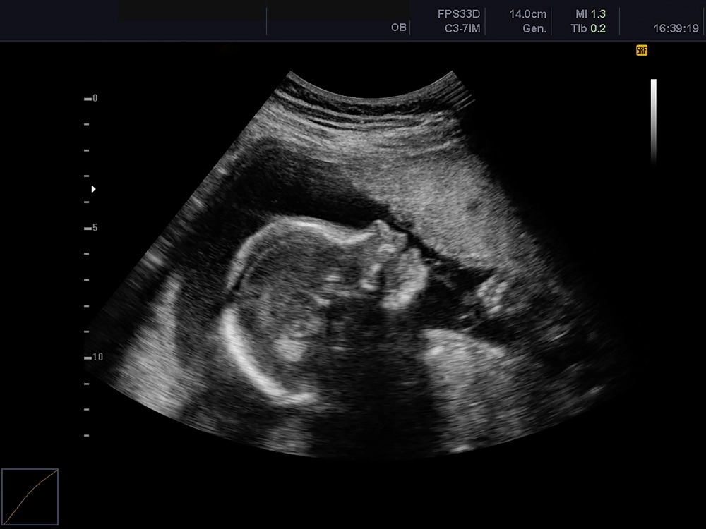 Skulle til babyscanning med sin kæreste: Så kom arbejdet med en chokerende besked