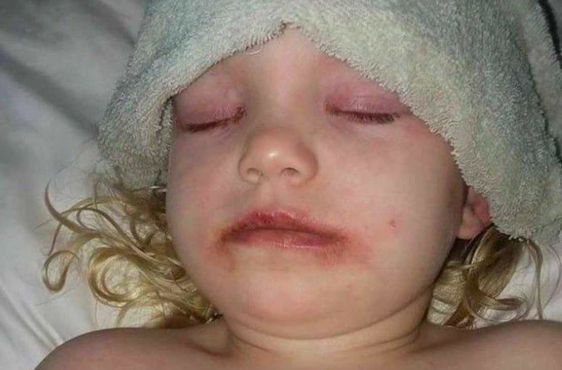 Forfærdet mor vil advare andre forældre med ubehageligt foto af 3-årig datter