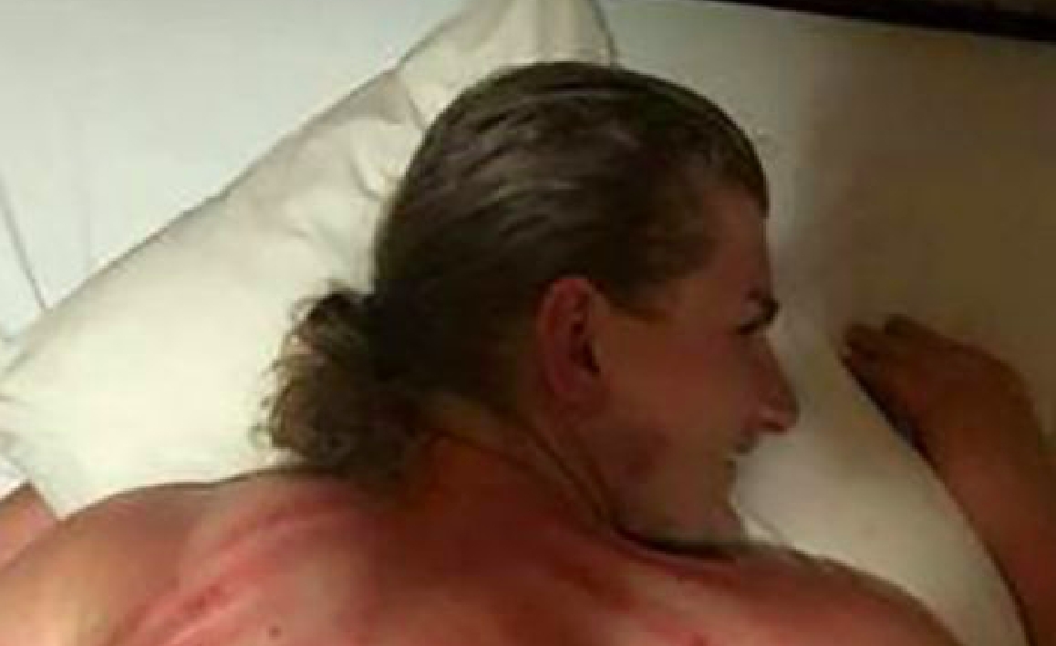 Turist nyder massage på ferie: Bliver forfærdet, da han ser sin ryg