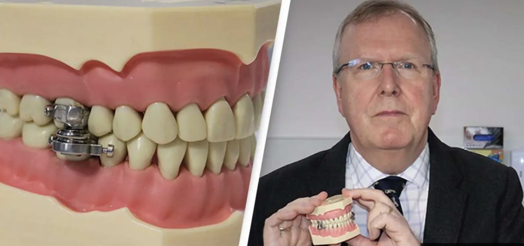 Forskere bliver kritiseret for at ville bekæmpe fedme ved at låse folks kæber