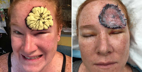 Tog fejl af plet i panden: Nu kommer hun med opfordring