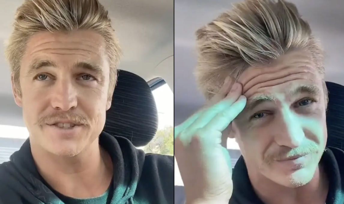 Mand overrasker: Det sker der, når man ikke vasker hår i seks år