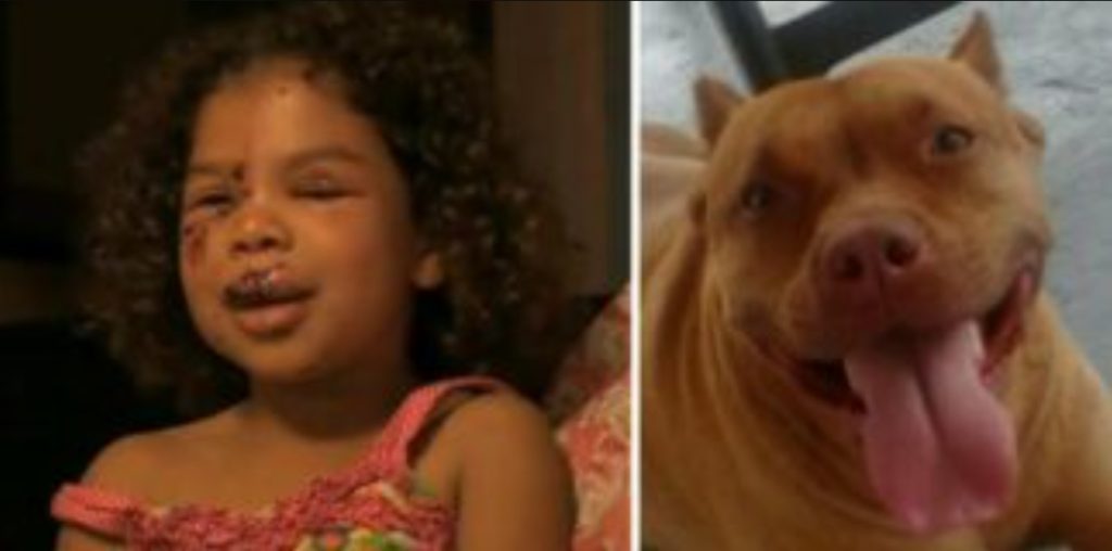 5-årig bliver bidt af naboens Labrador – dette sætter gang i familiens Pitbull, der gør det utænkelige