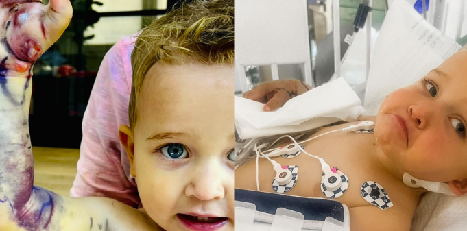 2-årig blev bidt af en klapperslange: Du gætter aldrig, hvor meget familien skulle betale for den livsvigtige behandling