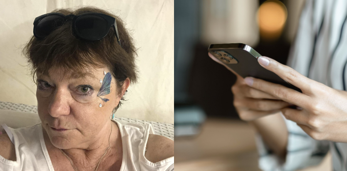 56-årig kvinde vågnede op med hævede øjne: Kort efter fik hun et opkald, der ændrede alt