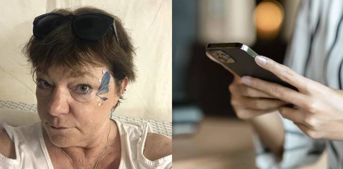 56-årig kvinde vågnede op med hævede øjne: Kort efter fik hun et opkald, der ændrede alt