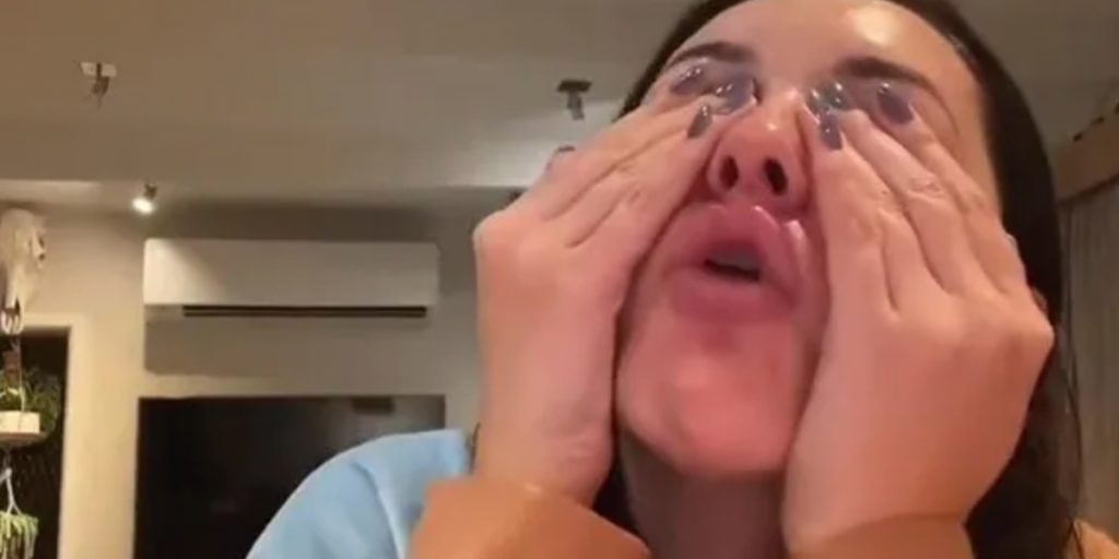 24-årige Annas Botox-behandling gik helt galt: Endte med et ‘skævt’ ansigt