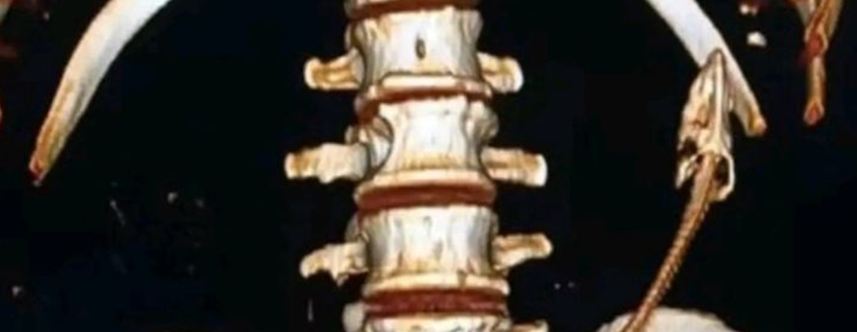 Mand putter dyr op i numsen: Du gætter ALDRIG hvorfor