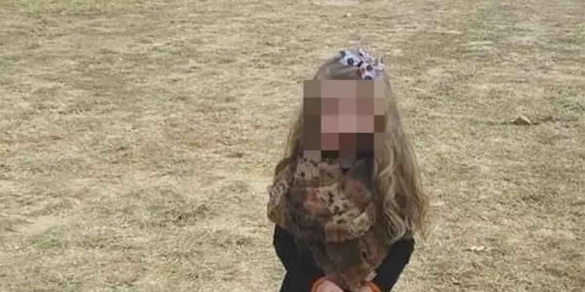 Internettet går amok over dette billede: Hvad er der galt med pigens ben?