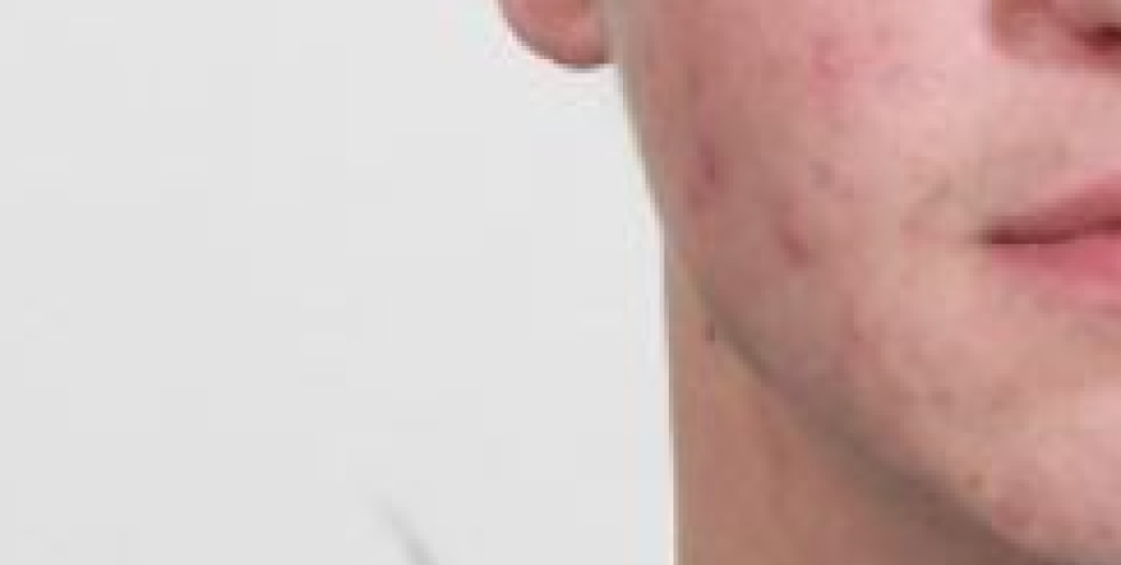 Se billedet: 23-årig mand efterlyst for afpresning, vold og frihedsberøvelse