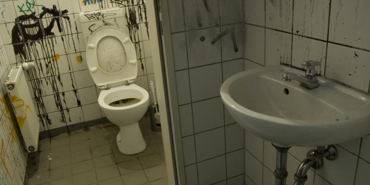 Mand fik fjernet 5 kilo tung lort, der havde skubbet hjertet over i højre side