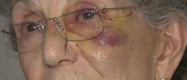 81-årig kvinde udsat for umotiveret overfald uden for sit hjem: ‘Jeg føler mig heldig’