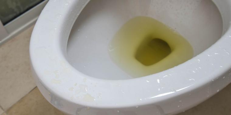 Kend dit tis: Det siger din urins farve om din krop