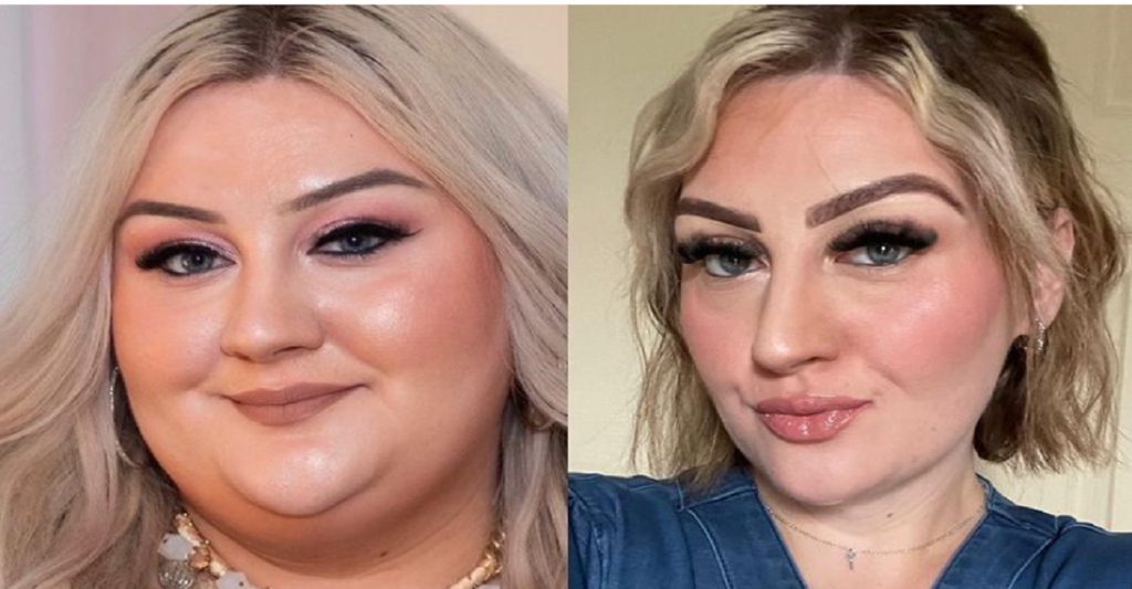 Victoria vejede 171 kilo og fik tabt sig 85 kilo: Det var starten på helvede for hende