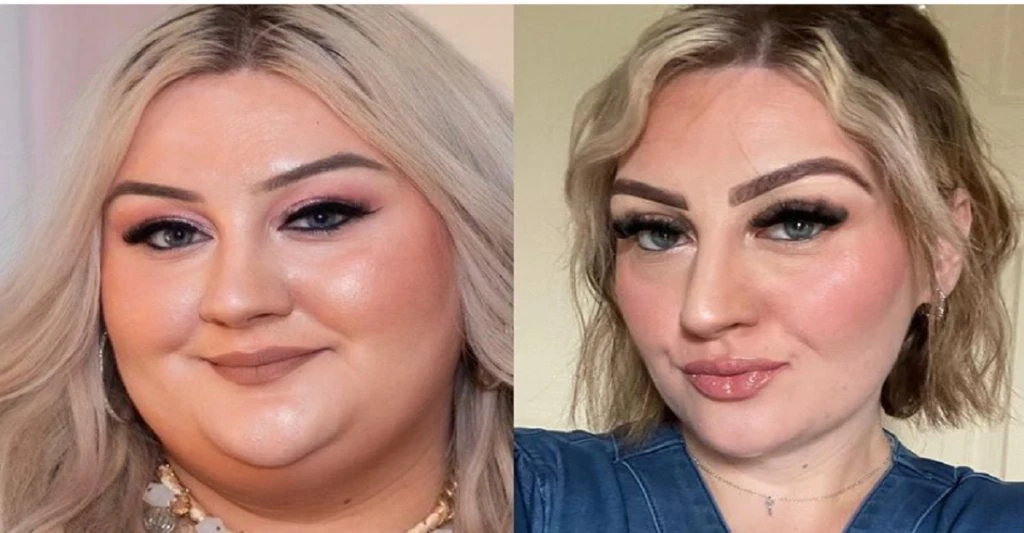 Victoria vejede 171 kilo og fik tabt sig 85 kilo: Det var starten på helvede for hende