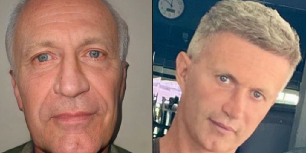 Mand får kirurgisk makeover i Tyrkiet: Ender med at se ’40 år yngre’ ud på ingen tid