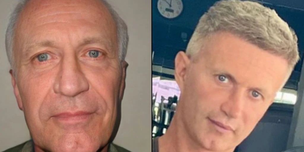 Mand får kirurgisk makeover i Tyrkiet: Ender med at se ’40 år yngre’ ud på ingen tid